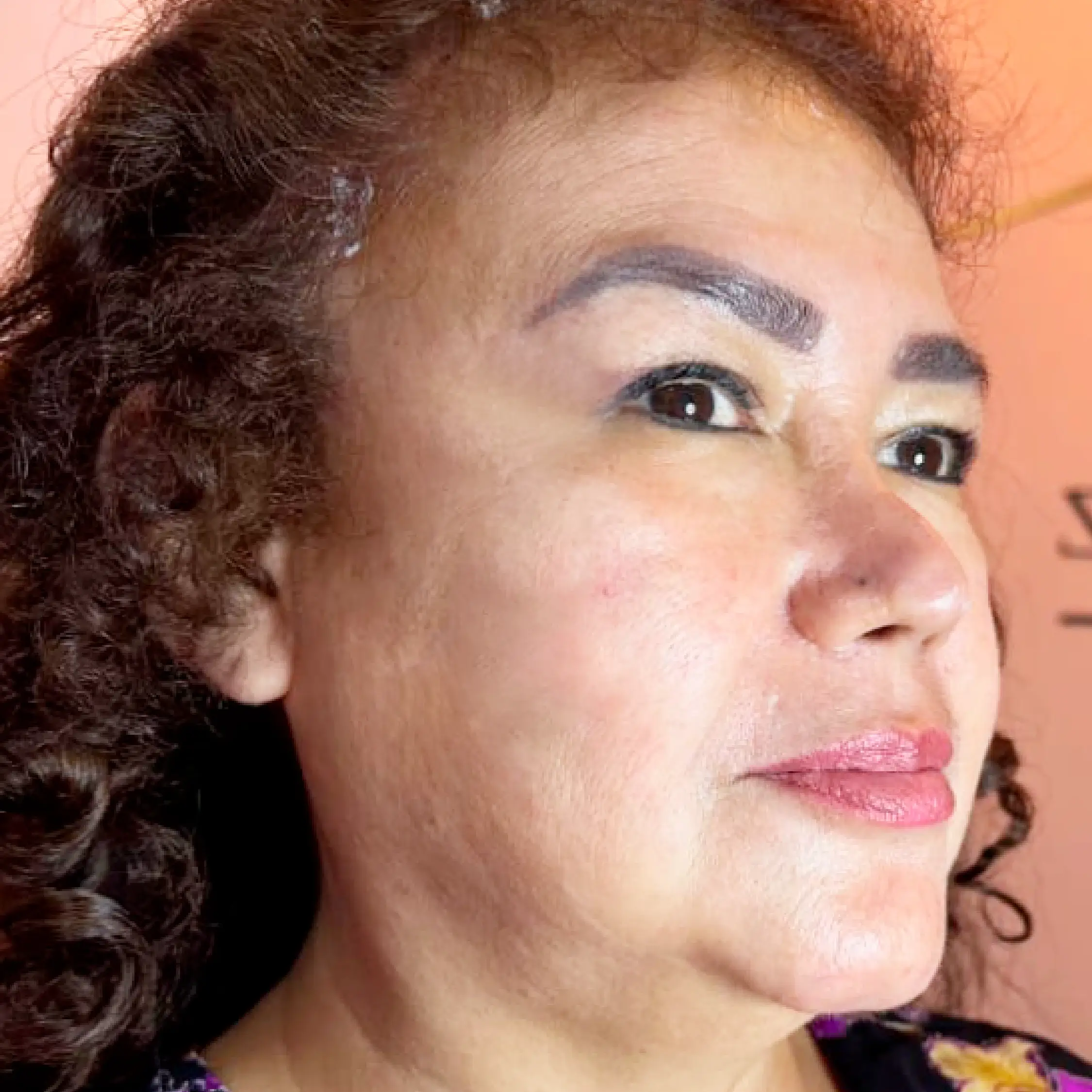 Después - Proyecto 5